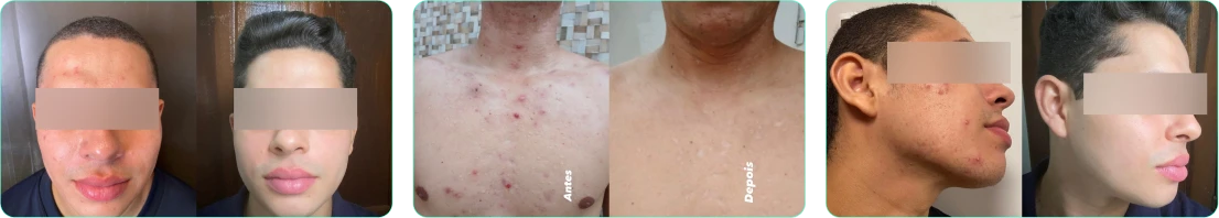 antes e depois